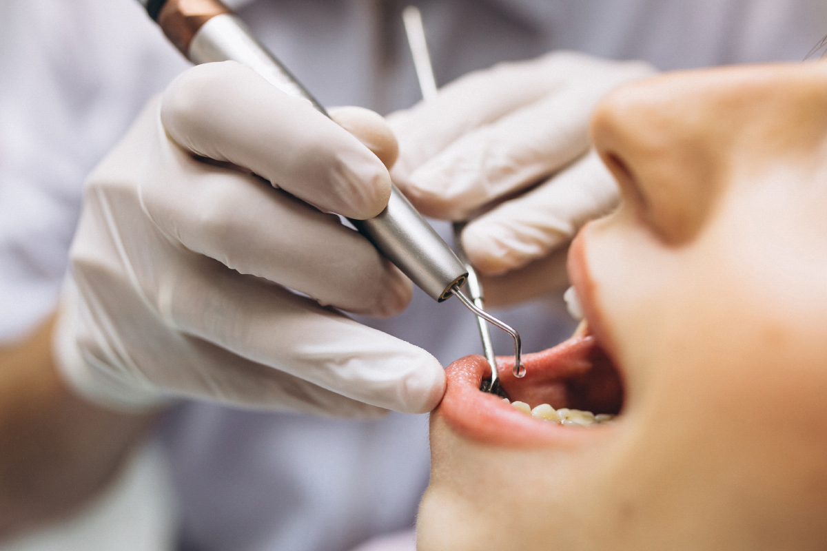 Periodoncia