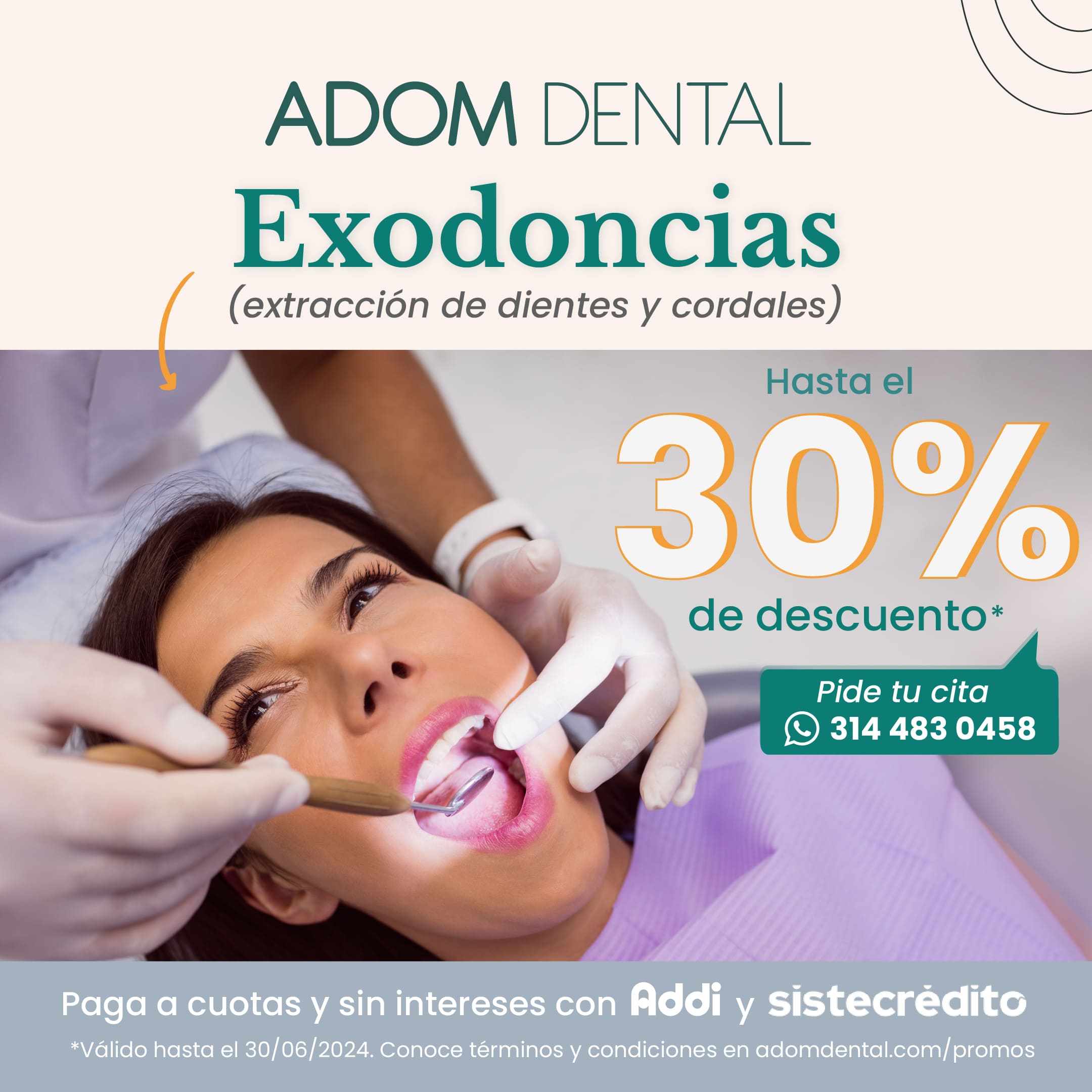 Exodoncia promo abril junio